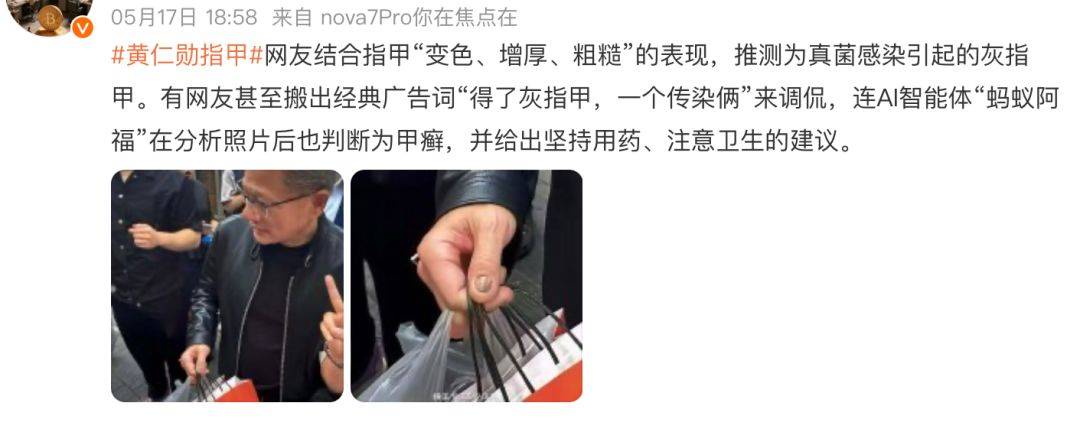 黄仁勋的指甲冲上热搜！高清镜头曝光，网友吵翻！医生：这6种情况都可能